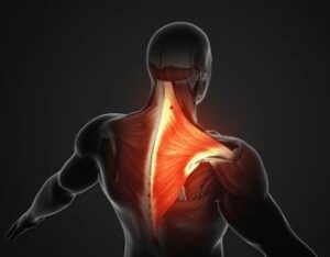 Diagram of the Trapezius muscle.