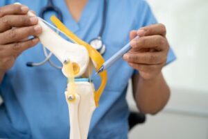 Orthopedic doctor explaining knee joint anatomy with model to discuss osteoarthritis and treatment options